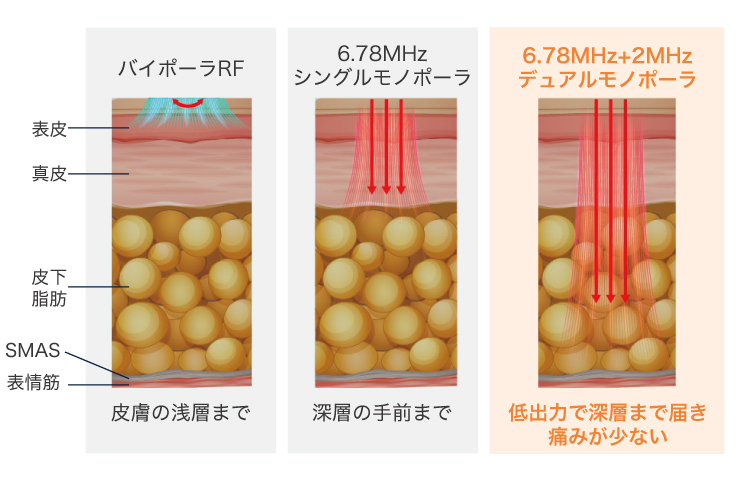 周波数の説明